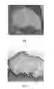 Fig. 05 - Use of dextran sulfate