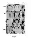 Fig. 12 - Method and composition for modulating canonical Wnt pathway using folate and inositol
