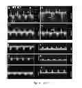 Fig. 13 - Method and composition for modulating canonical Wnt pathway using folate and inositol