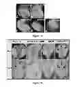 Fig. 19 - Method and composition for modulating canonical Wnt pathway using folate and inositol