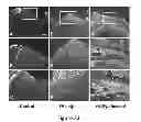Fig. 22 - Method and composition for modulating canonical Wnt pathway using folate and inositol