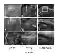 Fig. 24 - Method and composition for modulating canonical Wnt pathway using folate and inositol