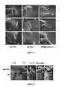 Fig. 25 - Method and composition for modulating canonical Wnt pathway using folate and inositol