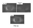 Fig. 27 - Pro-neurogenic compounds