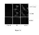 Fig. 05 - Method for regulating retinal endothelial cell viability