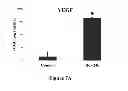 Fig. 15 - Method for regulating retinal endothelial cell viability