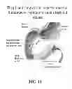 Fig. 13 - pH dependent carriers for targeted release of pharmaceuticals along the gastrointestinal tract, compositions therefrom, and making and using same