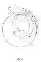 Fig. 16 - Adjusting energy of a particle beam