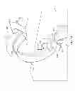 Fig. 17 - Controlling particle therapy
