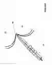 Fig. 14 - Methods, Systems, and Devices Relating to a Removable Percutaneous Interface Line