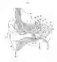 Fig. 02 - Adjustable fixation device having reduced infection