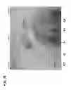 Fig. 33 - Imaging Catheter System
