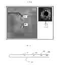 Fig. 09 - Accounting for non-uniform longitudinal motion during movement of an endoluminal imaging probe