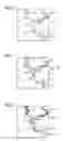 Fig. 03 - Angiographic examination method for the representation of flow properties