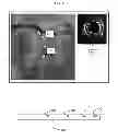 Fig. 09 - Displaying a device within an endoluminal image stack
