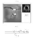 Fig. 09 - Apparatus and methods for determining a dimension of a portion of a stack of endoluminal data points