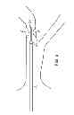 Fig. 06 - OPTICAL COHERENCE TOMOGRAPHY AND PRESSURE BASED SYSTEMS AND METHODS