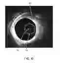 Fig. 15 - OPTICAL COHERENCE TOMOGRAPHY AND PRESSURE BASED SYSTEMS AND METHODS
