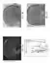 Fig. 04 - Computatonal tool for pre-surgical evaluation of patients with medically refractory epilepsy
