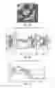 Fig. 10 - Computatonal tool for pre-surgical evaluation of patients with medically refractory epilepsy