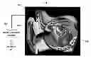 Fig. 01 - Apparatus and methods for acoustically or mechanically stimulating a cochlea and intracochlear recording of mechanically or acoustically evoked auditory potentials in the cochlea