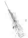 Fig. 08 - Tetherless biopsy device