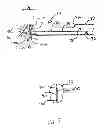Fig. 06 - Needle tip for biopsy device