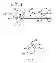 Fig. 07 - Needle tip for biopsy device