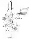 Fig. 01 - DISTRACTOR FOR MEASURING LOAD AND POSITION OF LOAD APPLIED BY THE MUSCULAR-SKELETAL SYSTEM AND METHOD THEREFOR