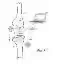 Fig. 02 - DISTRACTOR FOR MEASURING LOAD AND POSITION OF LOAD APPLIED BY THE MUSCULAR-SKELETAL SYSTEM AND METHOD THEREFOR