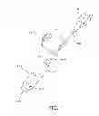 Fig. 02 - INTRAUTERINE PRESSURE CATHETER INTERFACE CABLE SYSTEM