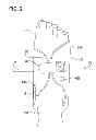 Fig. 03 - Vascular compression system