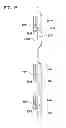 Fig. 16 - Vascular compression system
