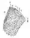Fig. 12 - Wound dressing