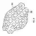 Fig. 17 - Wound dressing