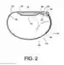 Fig. 03 - Compression wrap