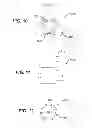Fig. 06 - Tympanic membrane pressure equalization tube