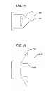 Fig. 09 - Tympanic membrane pressure equalization tube