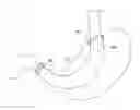 Fig. 01 - Satiation devices and methods