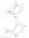 Fig. 06 - Satiation devices and methods