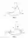 Fig. 07 - Satiation devices and methods