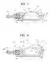 Fig. 03 - Valve system and method with multi-directional pumping
