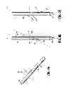 Fig. 08 - Symmetrical tip acute catheter