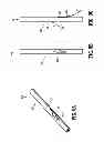 Fig. 09 - Symmetrical tip acute catheter
