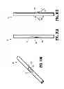 Fig. 10 - Symmetrical tip acute catheter