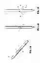 Fig. 11 - Symmetrical tip acute catheter