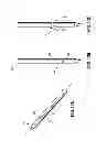 Fig. 13 - Symmetrical tip acute catheter