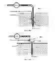 Fig. 08 - Fluid delivery system with electrochemical sensing of analyte concentration levels