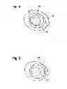 Fig. 03 - Guide Device for Intraocular Injection