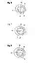 Fig. 04 - Guide Device for Intraocular Injection